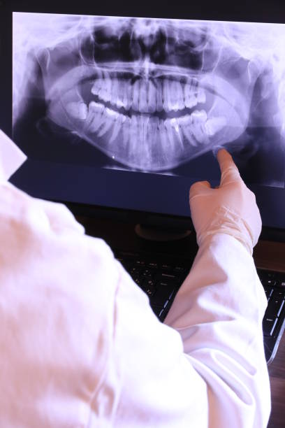 Best Dentist for Tooth Abscess  in Four Oaks, NC