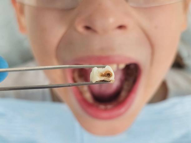 Best Emergency Gum Pain Relief  in Four Oaks, NC