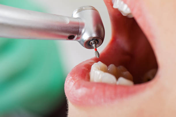 Best 24-Hour Emergency Dentist  in Four Oaks, NC